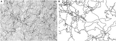 Serotonergic Axons as Fractional Brownian Motion Paths: Insights Into the Self-Organization of Regional Densities